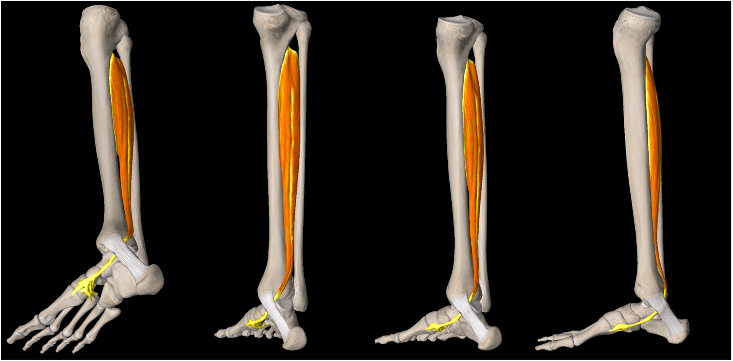 Tibialis Posterior