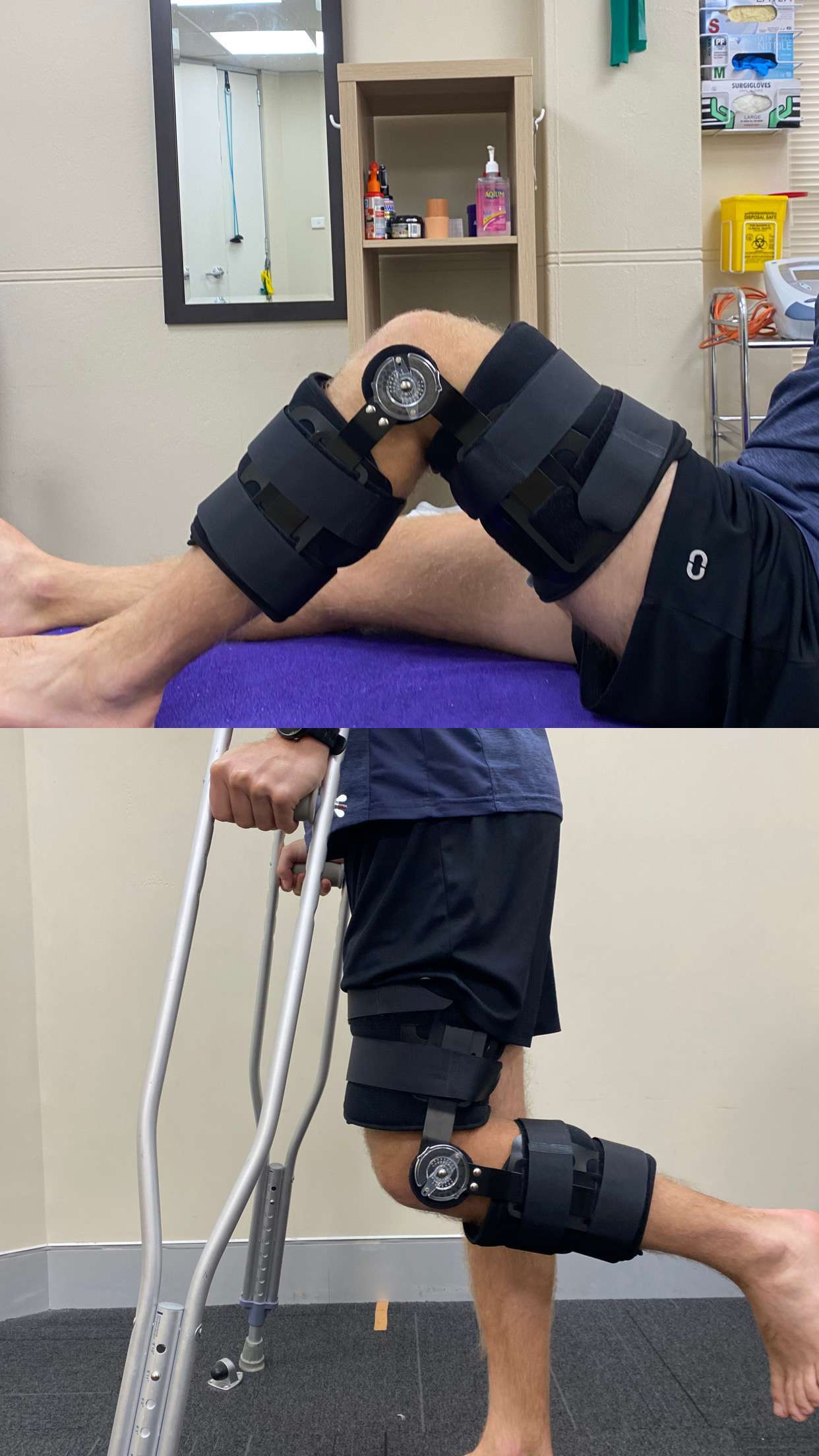 ACL Knee Brace  ACL Brace - Torn Anterior Cruciate Ligament